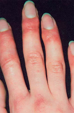 20081119170315-sabanon.jpg